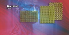 Titanium Mesh Nets and Gratings - Maxillo Facial Trauma