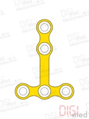 T-Platte, Titan, 5 Loch, Profil 0.6mm, System 2.0mm