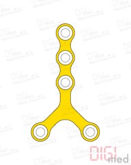 Y-Platte, Titan, 5 Loch, Profil 0.75mm, System 2.0mm