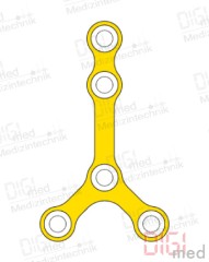 Y-Platte, Titan, 5 Loch, Profil 1.0mm, System 2.0mm