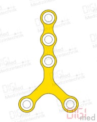 Y-Platte, Titan, 5 Loch, Profil 1.0mm, System 2.0mm